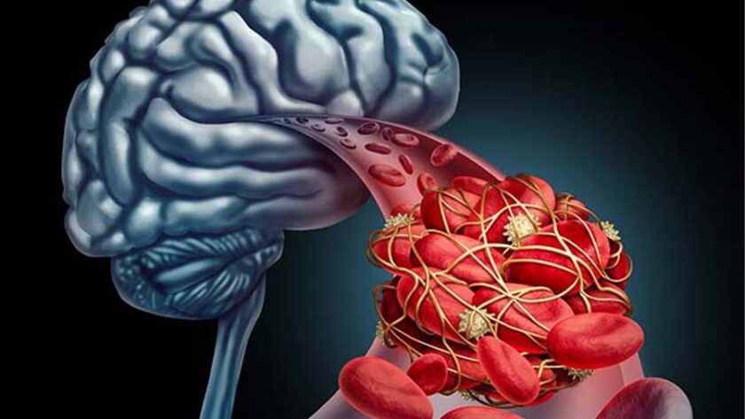 animación cerebro