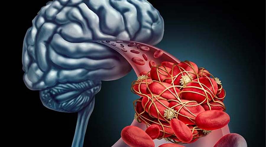 animación cerebro