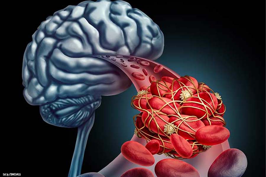 animación cerebro