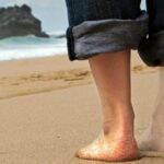 hombre en la playa con sindrome del miembro fantasma